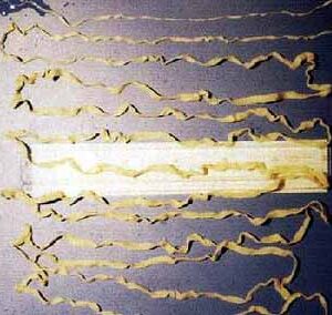 クジラ複殖門条虫（大複殖門条虫）